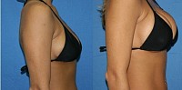 AGRANDIR VOS SEINS RAPIDEMENT -AUGMENTER LES SEINS